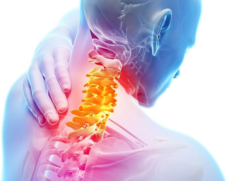 gimdos kaklelio osteochondrozės simptomai